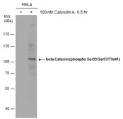 Anti-beta Catenin (phospho Ser33/Ser37/Thr41) antibody used in Western Blot (WB). GTX132605